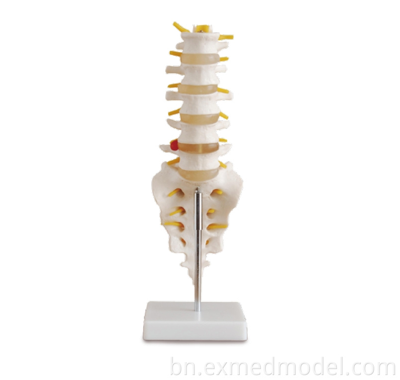 Life-size Lumbar Vertebra with Sacrum & Coccyx and Herniated Disc
